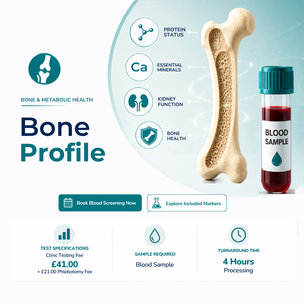 Bone-in-london-at-medical-diagnosis-victoria