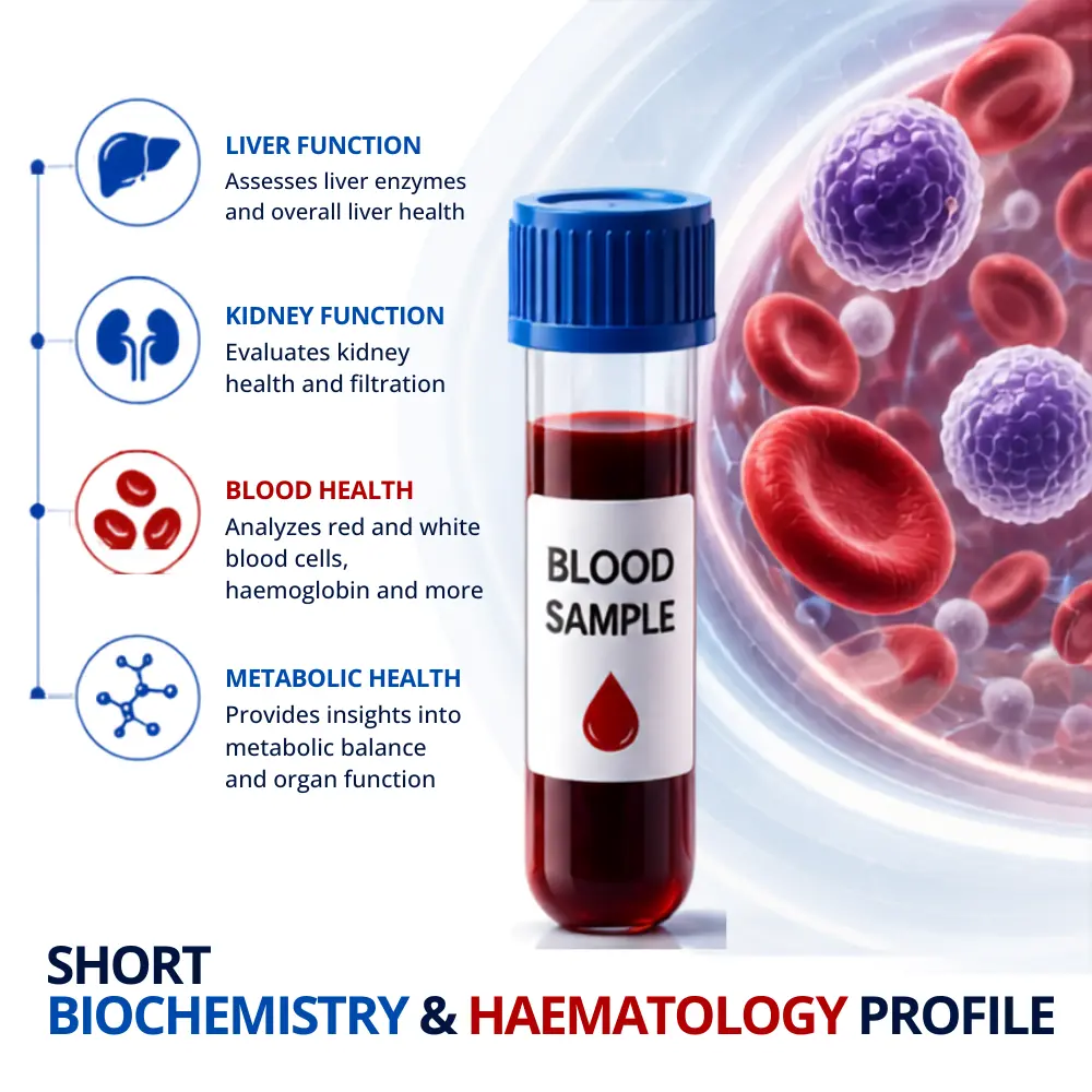 Short Biochemistry & Haematology Profile in london at medical diagnosis victoria