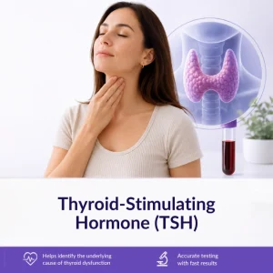 Private Thyroid-Stimulating Hormone (TSH) Blood Test London MDX Victoria