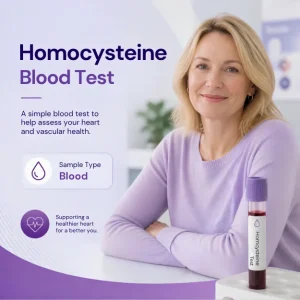 Homocysteine Blood Test London MDX Victoria