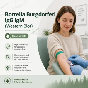Private Borrelia Burgdorferi IgG IgM (Western Blot) blood test in London MDX Victoria