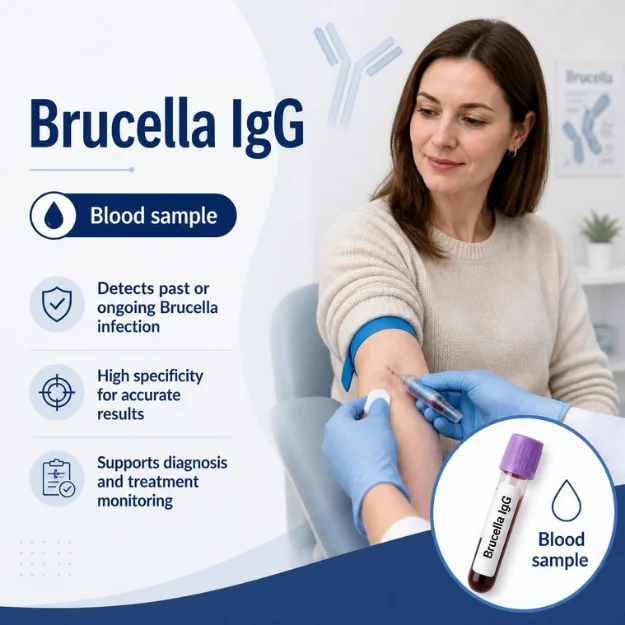 Private Brucella IgG blood test in London MDX Victoria